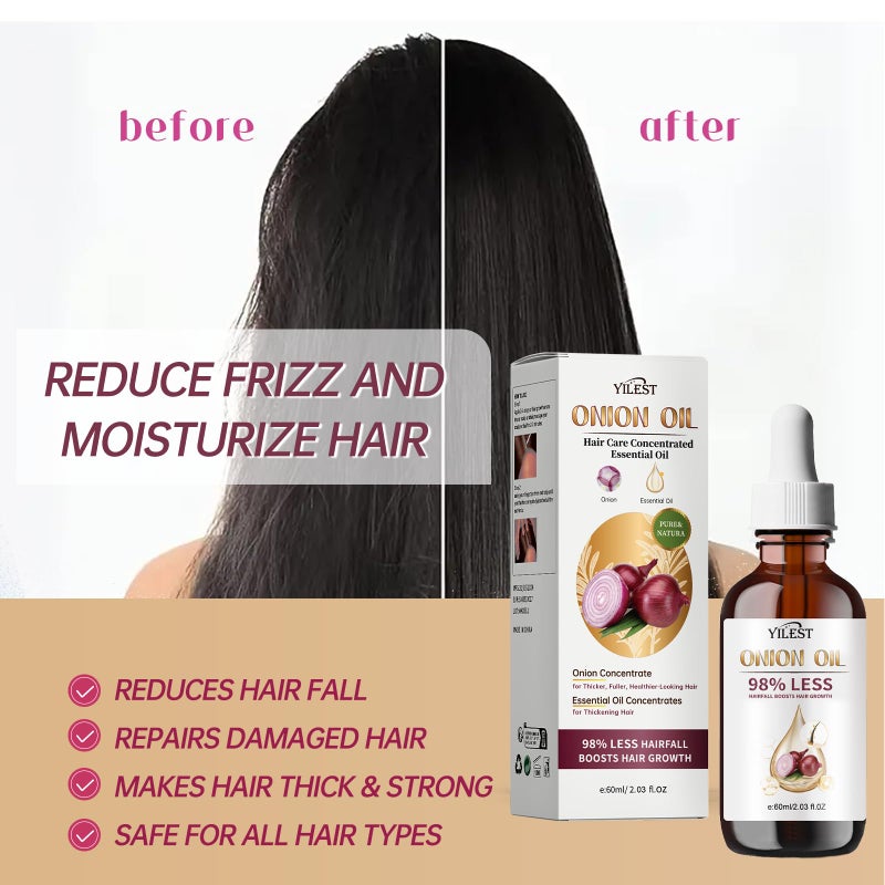 YILEST Onion & Rosemary Hair Growth Serum with Biotin & Arginine - Hydrating Scalp Treatment for Thicker Hair, 60ml - Image 3